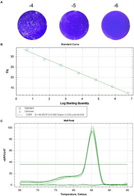 Establishment of a reverse transcription real-time quantitative PCR method for Getah virus detection and its application for epidemiological investigation in Shandong, China